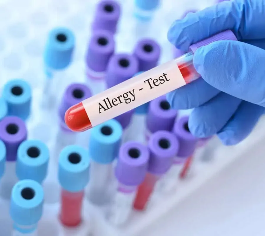 gut-allergy-testing-in-services-by-edge-aesthetics-and-wellness-in-royal-palm-beach-fl gut-allergy-testing-in-services-by-edge-aesthetics-and-wellness-in-royal-palm-beach-fl