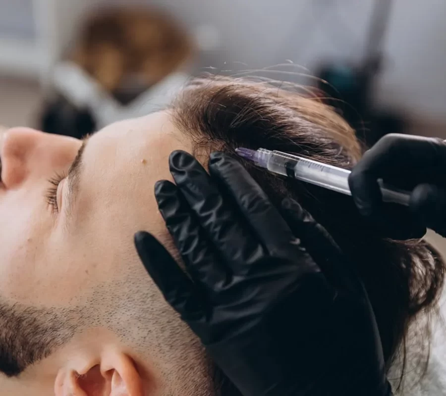 hair-restoration-with-prp-at-edge-aesthetics-and-wellness-in-royal-palm-beach-fl