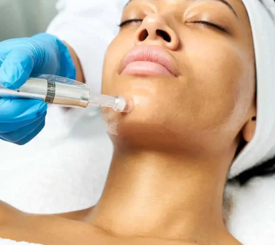 microneedling-integrity-in-services-by-edge-aesthetics-and-wellness-in-royal-palm-beach-fl